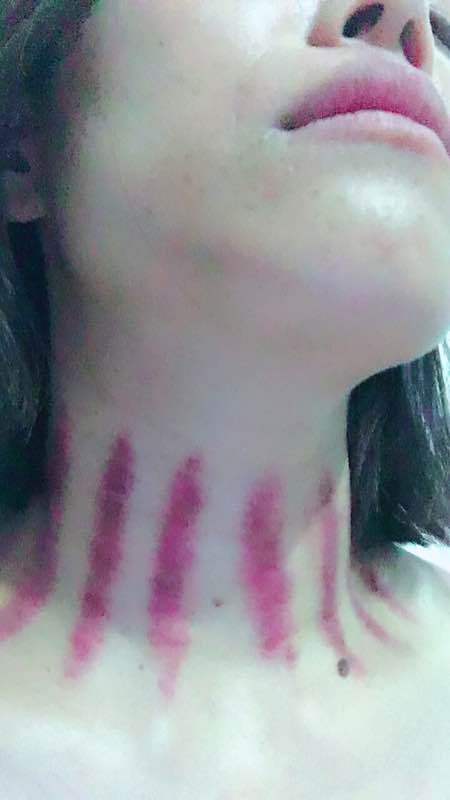 揪痧之美，最新時尚潮流相冊分享，領略揪痧的獨特魅力