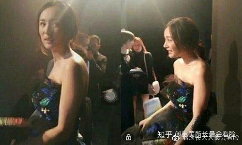 駝背女明星的逆襲之旅，塑造優(yōu)雅體態(tài)的勵(lì)志之旅?