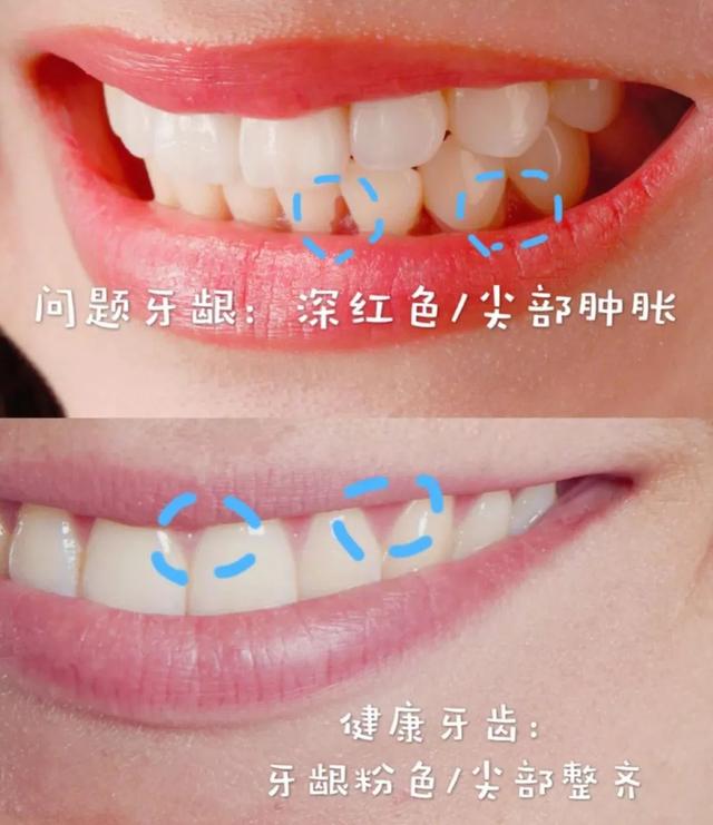 “口臭牙問題解析”,口臭牙問題解析，一顆牙齒的奇妙冒險