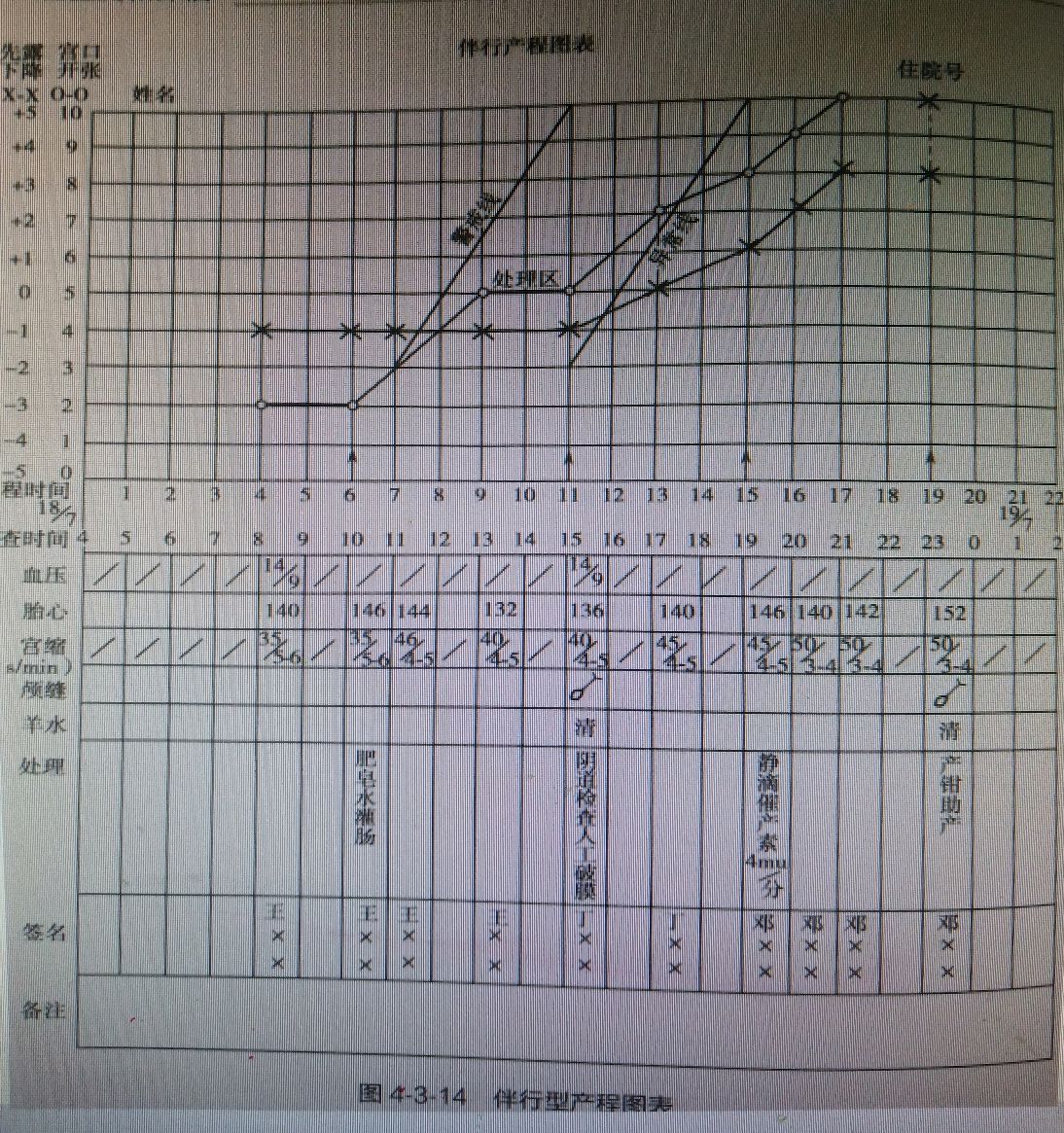 最新產程圖及其觀點論述解析