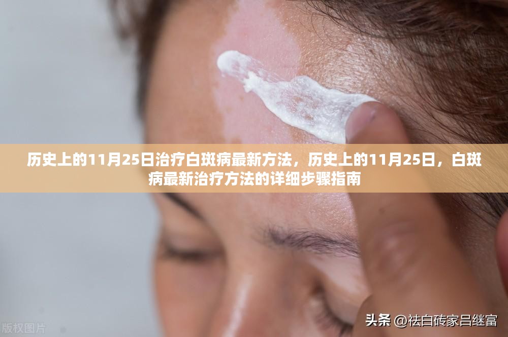 白斑最新技術的神奇探索之旅