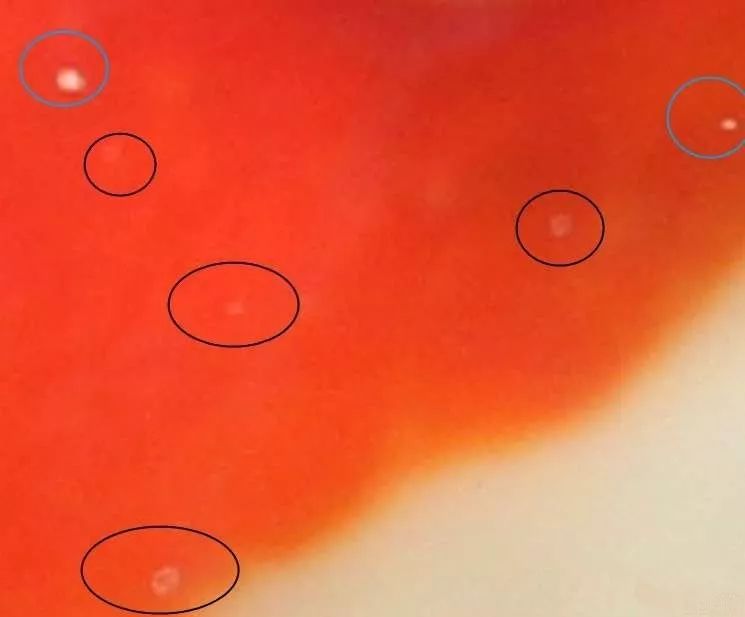 白點最新技術(shù)，革新醫(yī)療領(lǐng)域的突破性進(jìn)展