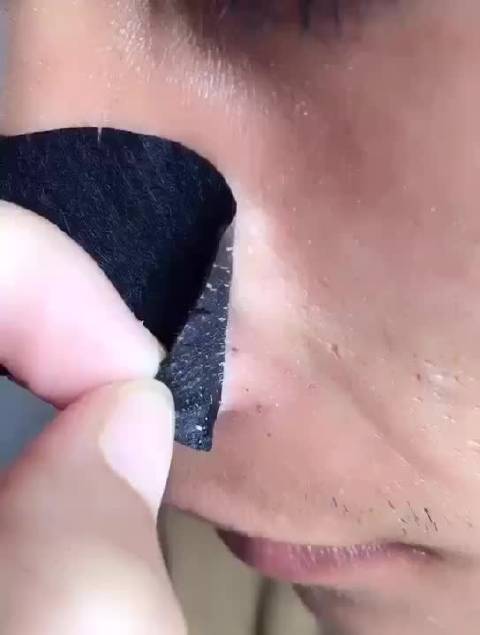 擠黑頭最新視頻，探索小巷特色小店，黑頭治理新秘境揭秘！